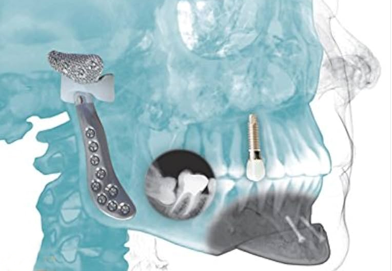 Ağız Diş Çene Hastalıkları ve Cerrahisi